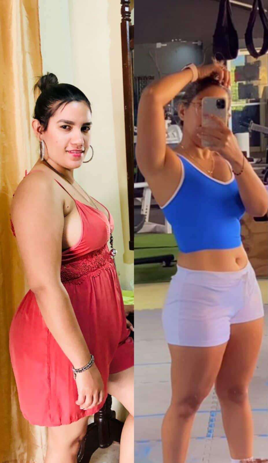 Antes y Después Karina